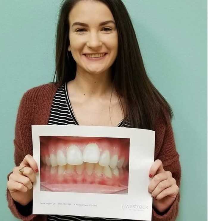 A patient named Magan showing off her new smile next to a picture of her smile before