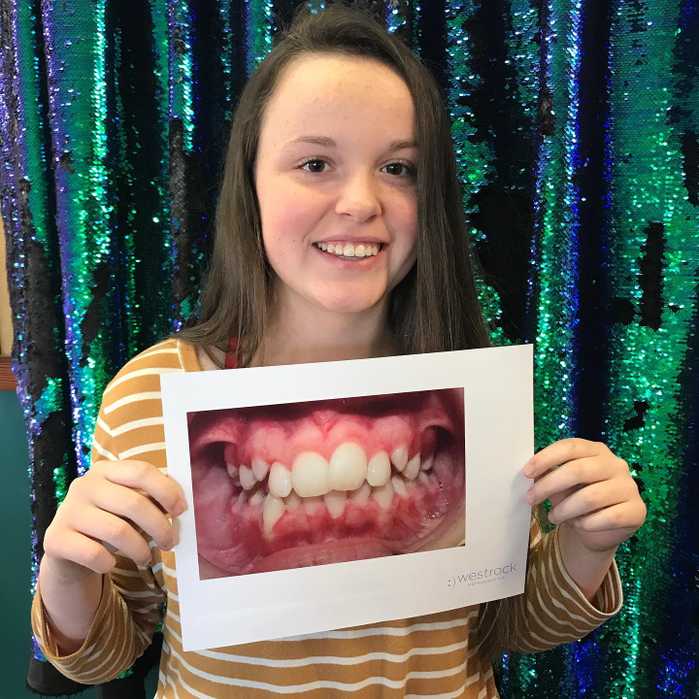 A patient named Jayden showing off her new smile next to a picture of her smile before